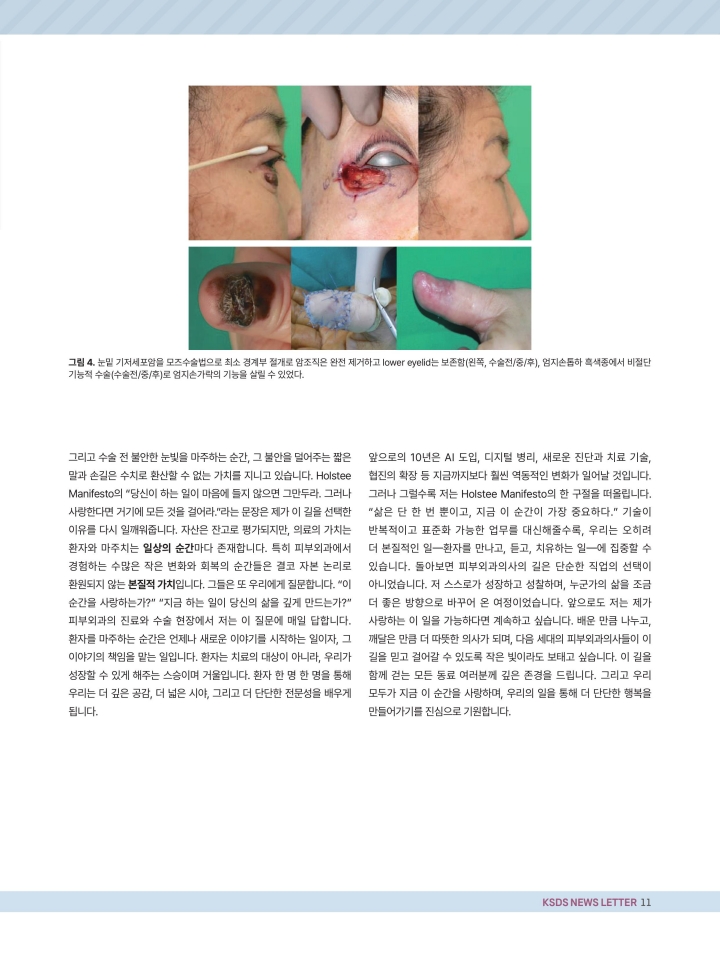 피부외과 뉴스레터 7-1 (5-1)-이미지-10.jpg